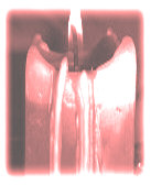 candle making supplies